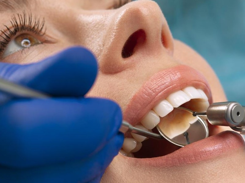 Liječenje zuba oštećenog korijenskog kanala zuba